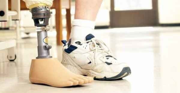 Despesas com próteses e tecnologias assistivas poderão ser deduzidas do IR