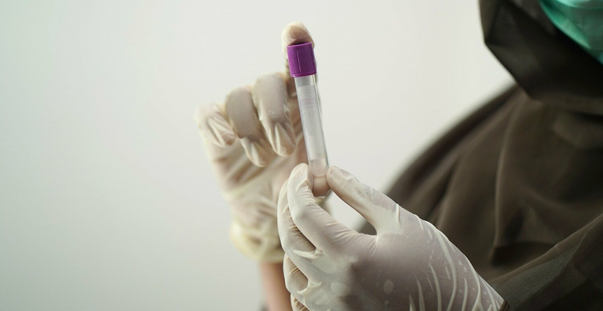 Exames discriminatórios em processo seletivo fere direitos fundamentais dos candidatos